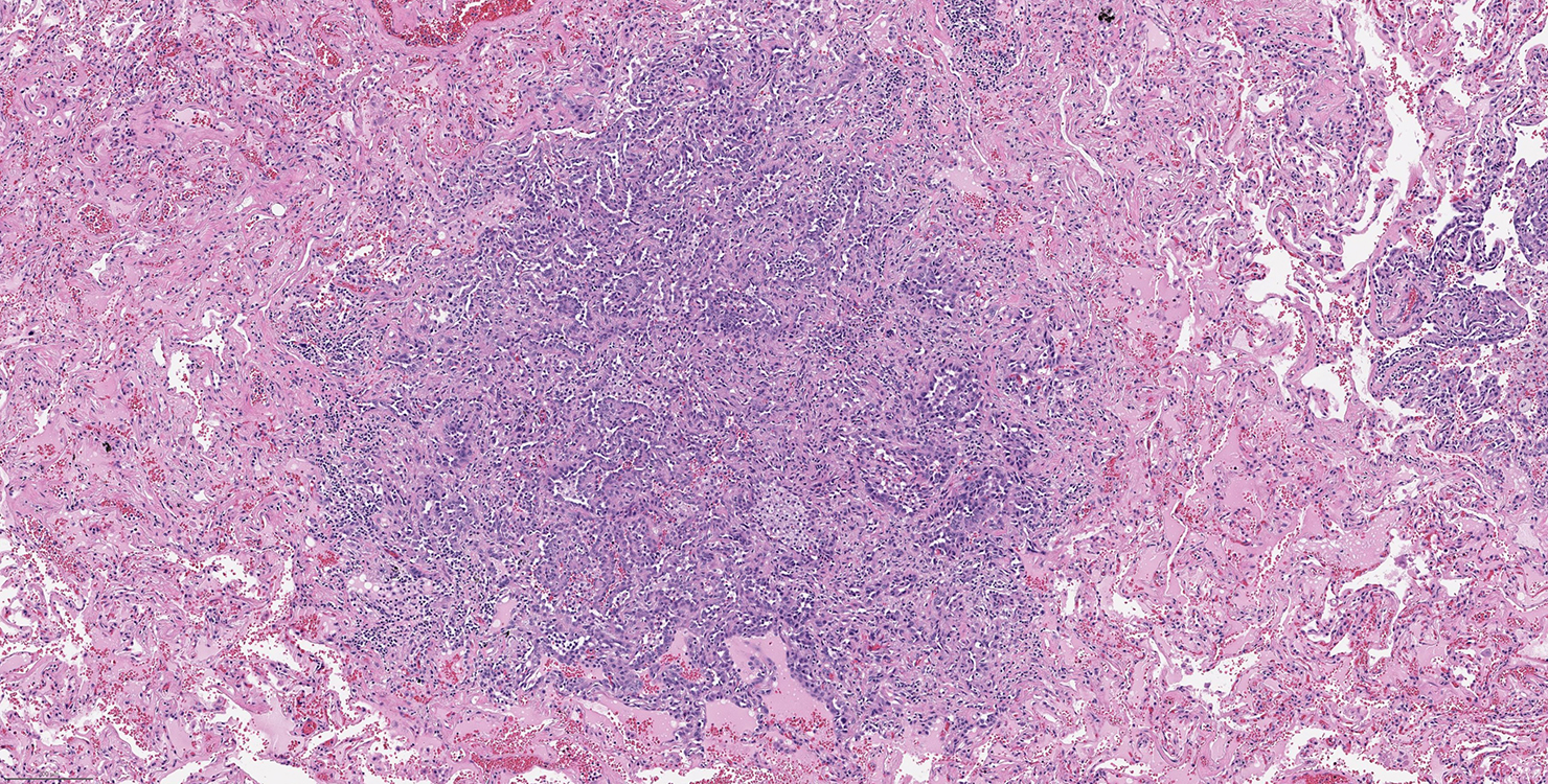 Figure 2_Med power H&E